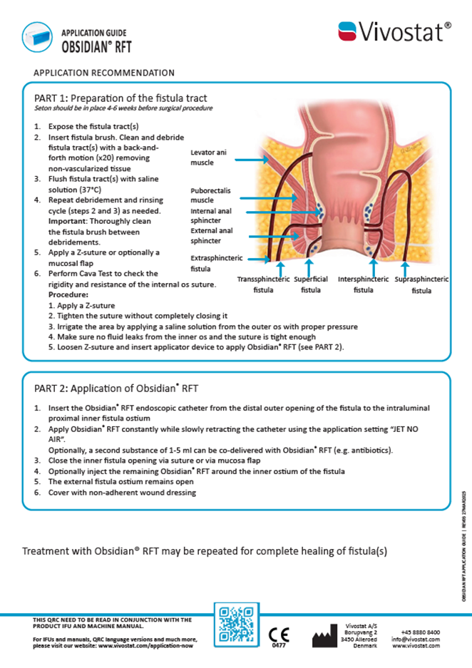 Quick reference card (QRC) for application of Obsidian® RFT from Vivostat®